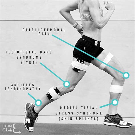 Running Injuries .